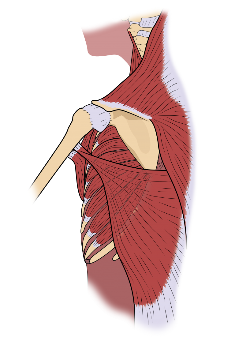 shoulder-rehab-after-breast-cancer-de-souza-institute